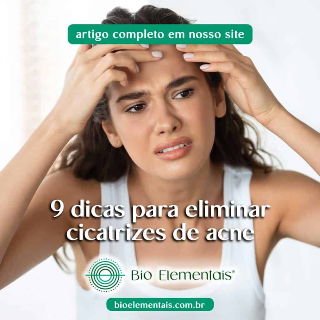 9 dicas para eliminar cicatrizes de acne